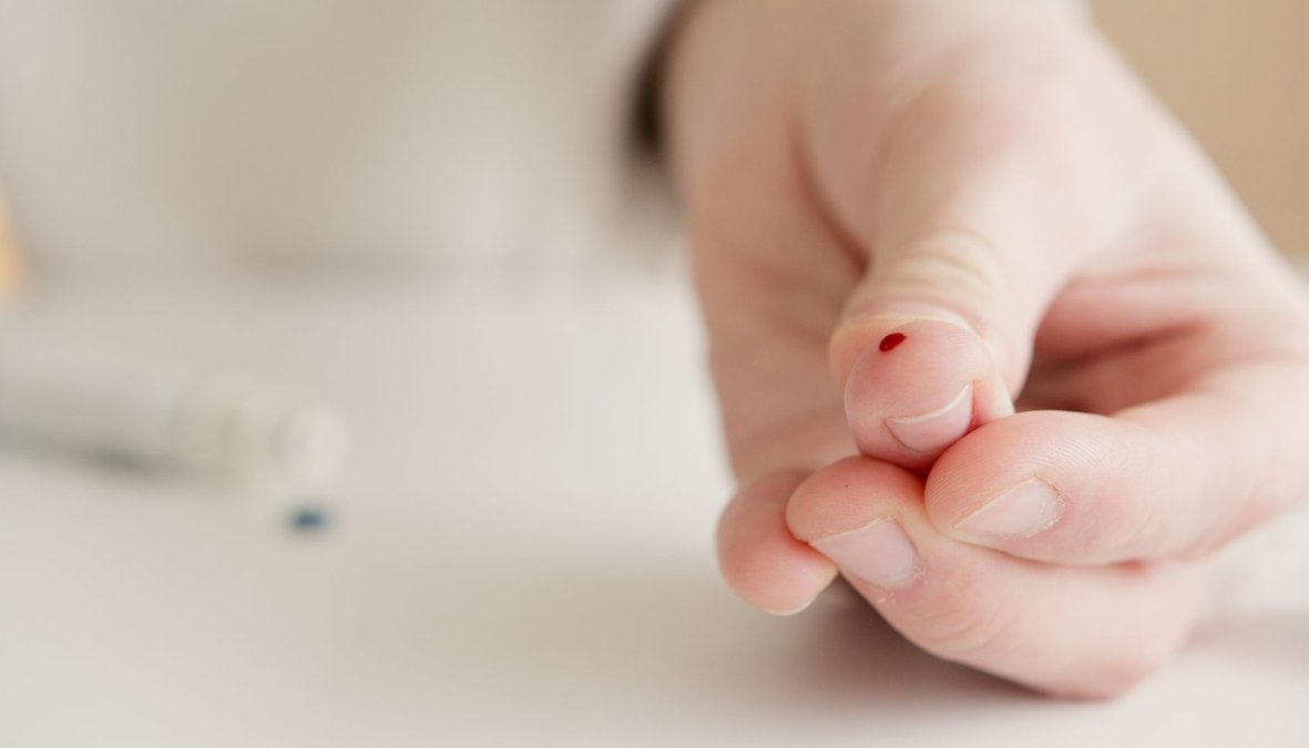 Punción digital para una prueba rápida de VIH, con una gota de sangre lista para el análisis